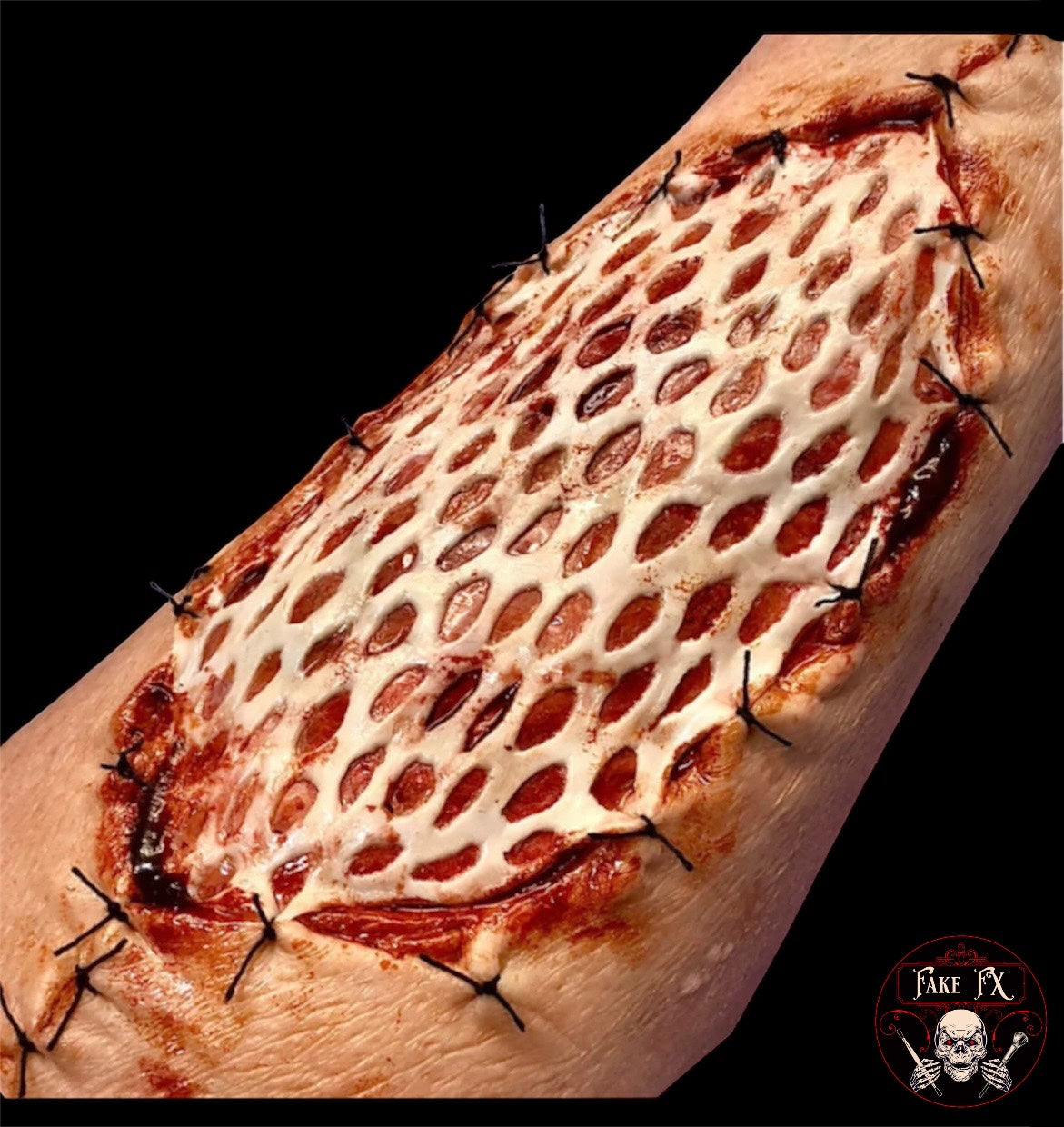 Skin Graft Prosthetic
