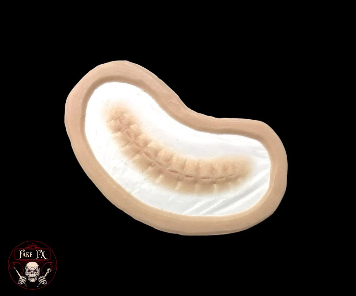 Small Stitch Prosthetic