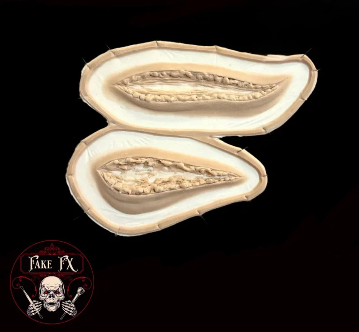 Large prosthetic wound set