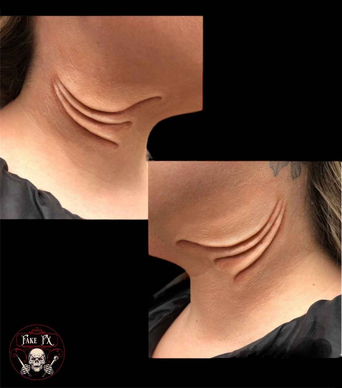 Gill Prosthetics